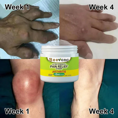 Bee Venom Joint and Muscle Therapy Cream (🔥Buy 1 get 2 FREE Today Only)